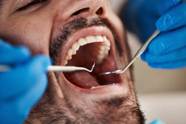 Best Tooth Extraction  in Nappanee, IN